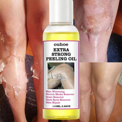 Yellow Peeling Oil 110ml Super Strength Dead Skin Remover